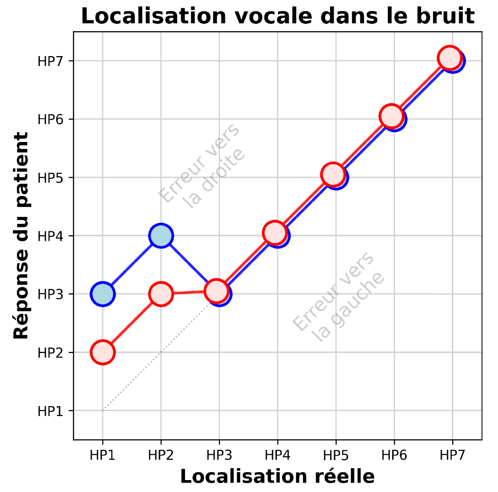 Suivi clinique de la localisation sonore